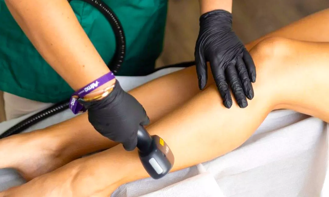 Depilacja laserowa Soprano Ice Platinum na wybraną partię ciała