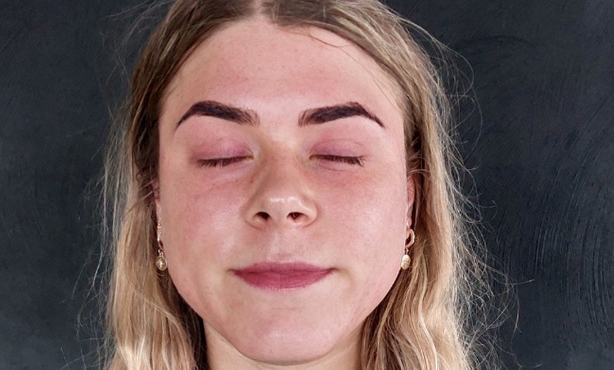 Image 11: Effectieve carbon laser peeling voor huidverjonging en collageenboost