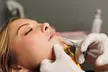 Up to 42% Off on Facial at APEX Performance & Aesthetics medical spa - Second Medium