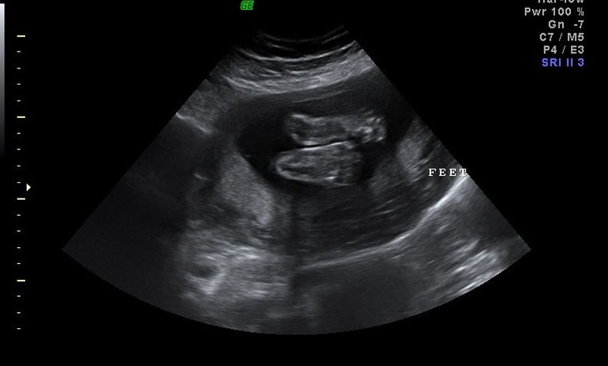 Image 4: 3D/ 4D Baby Scan