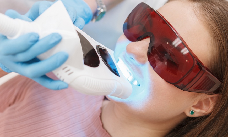 Image 1: 1-2 Kosmetische Zahn-Bleachings inkl. Beratung für 1 Person