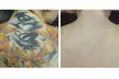 One Tattoo Removal Session on Small, Medium, or Large Area at OmniLuminous (Up to 50% Off) - Second Medium