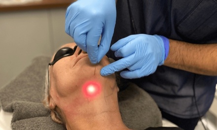 Endolifting Laser Treatment for Double Chin - Time for You