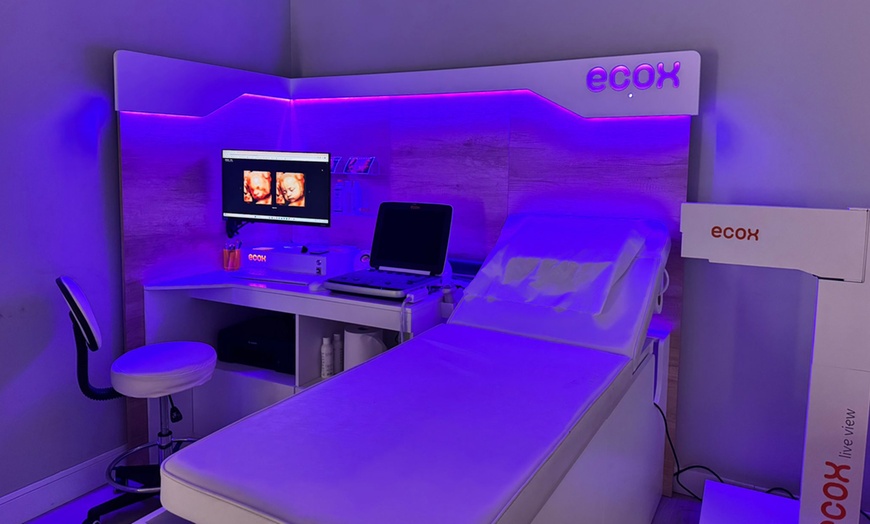 Image 2: ¡Conoce a tu bebé! Ecografía emocional 5D o 8K con vídeo y canastilla