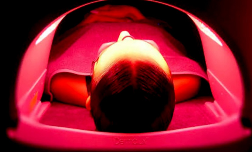 Image 4: Micro-Needling or Dermapen Micro-Needling w/ Hyaluronic Serum with LED