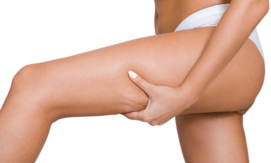 Image 1: Wertgutschein über 25 €, 50 € oder 75 € anrechenbar auf Sugaring