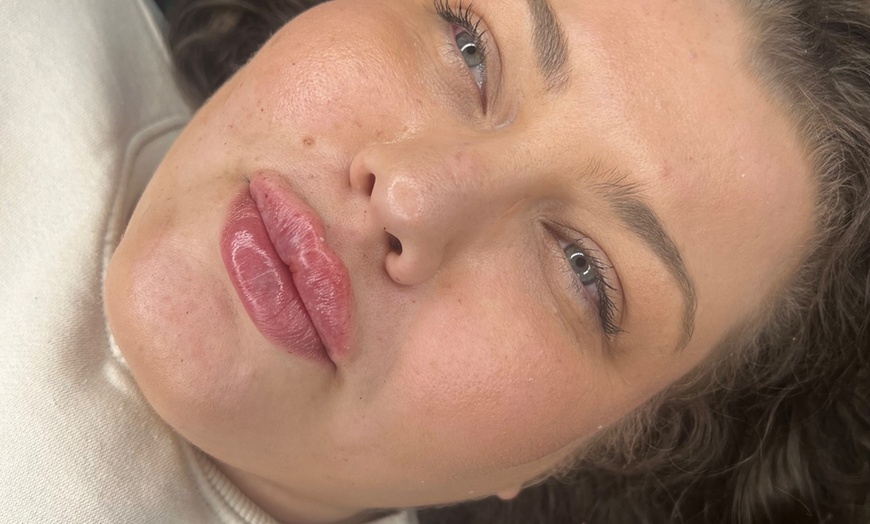 Image 2: 1 or 2 ML For Lip or Chin or Cheek with Consultation