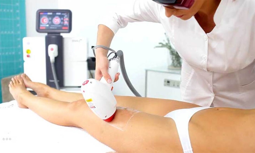 Image 11: Hasta 7 sesiones de depilación láser unisex 