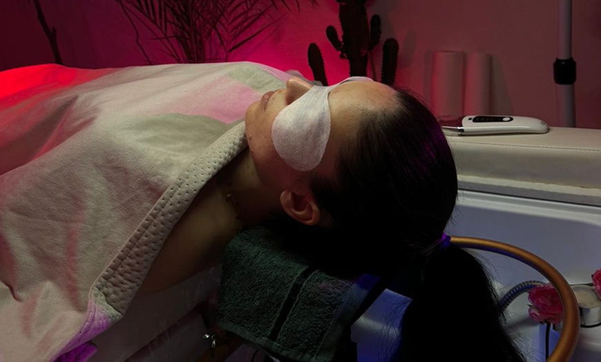 Image 8: 60 Min. Microneedling-Behandlung für Gesicht oder Körper für 1 Person 