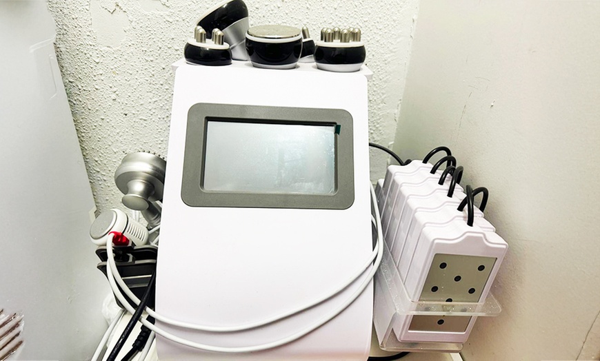 Image 10: Tratamiento facial con dermapen y opción a extras para 1 persona