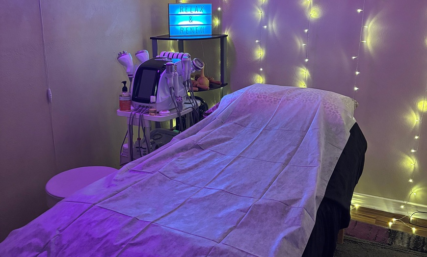 Image 1: Up to 58% Off on Fat Reduction - Non-Branded at De La Sol Beauty Studio