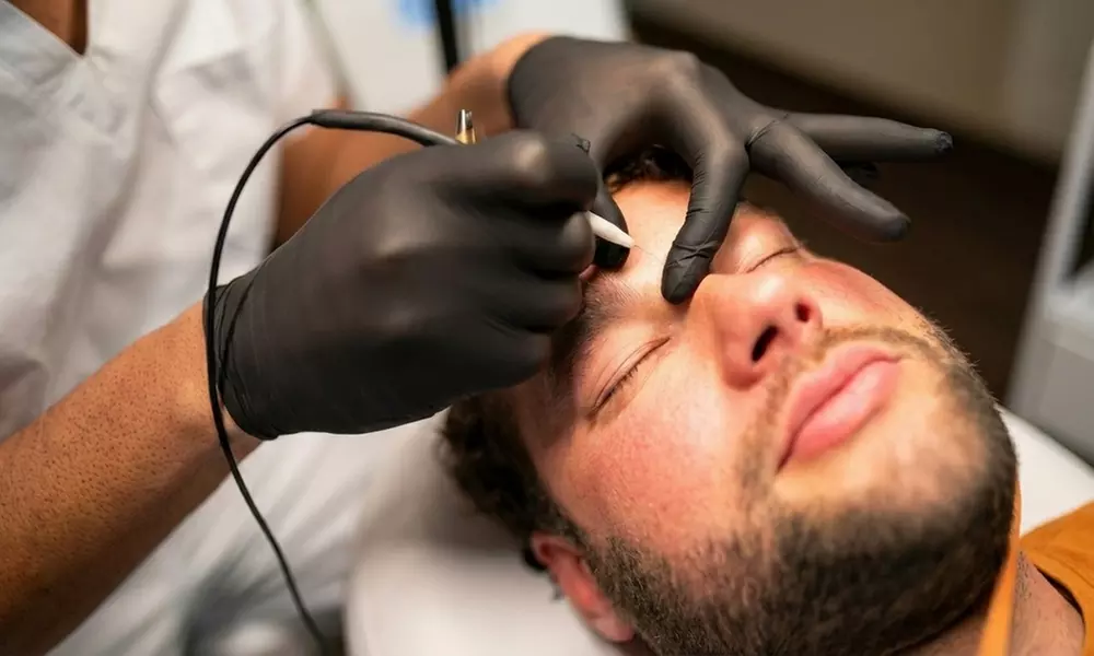 Elektrolyse: Präzise Haarentfernung bei jedem Haartyp