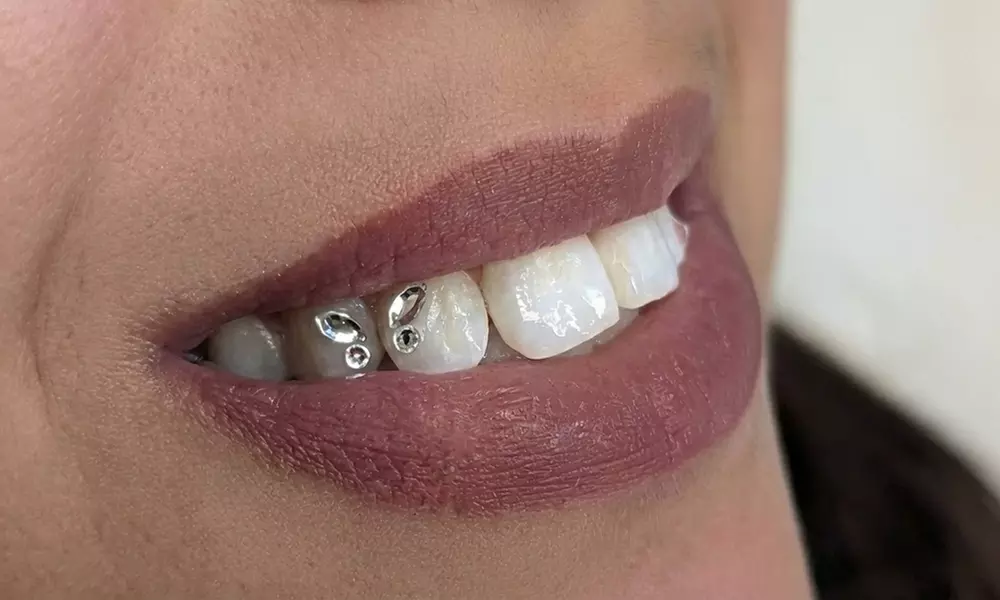 Dazzle Your Smile: 1, 2/ 4 Round, 1 Heart or 1 Butterfly Set Tooth Gem