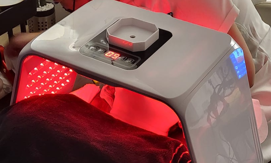 Image 2: Hydra facial, radiofrecuencia, fototerapia y electroestimulación