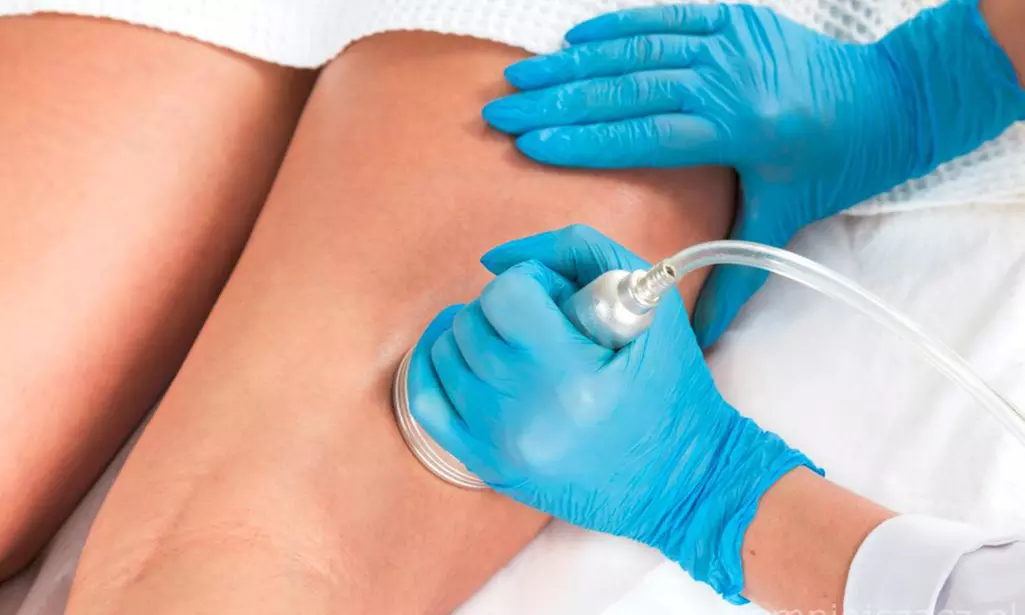 Zabieg toksyną botulinową na 1-3 partie twarzy w Klinice Anna Pikura