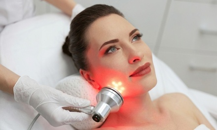 IPL-Photofacial Laser Rejuvenation Treatment for the Face - AZ Laser RX & Med Spa