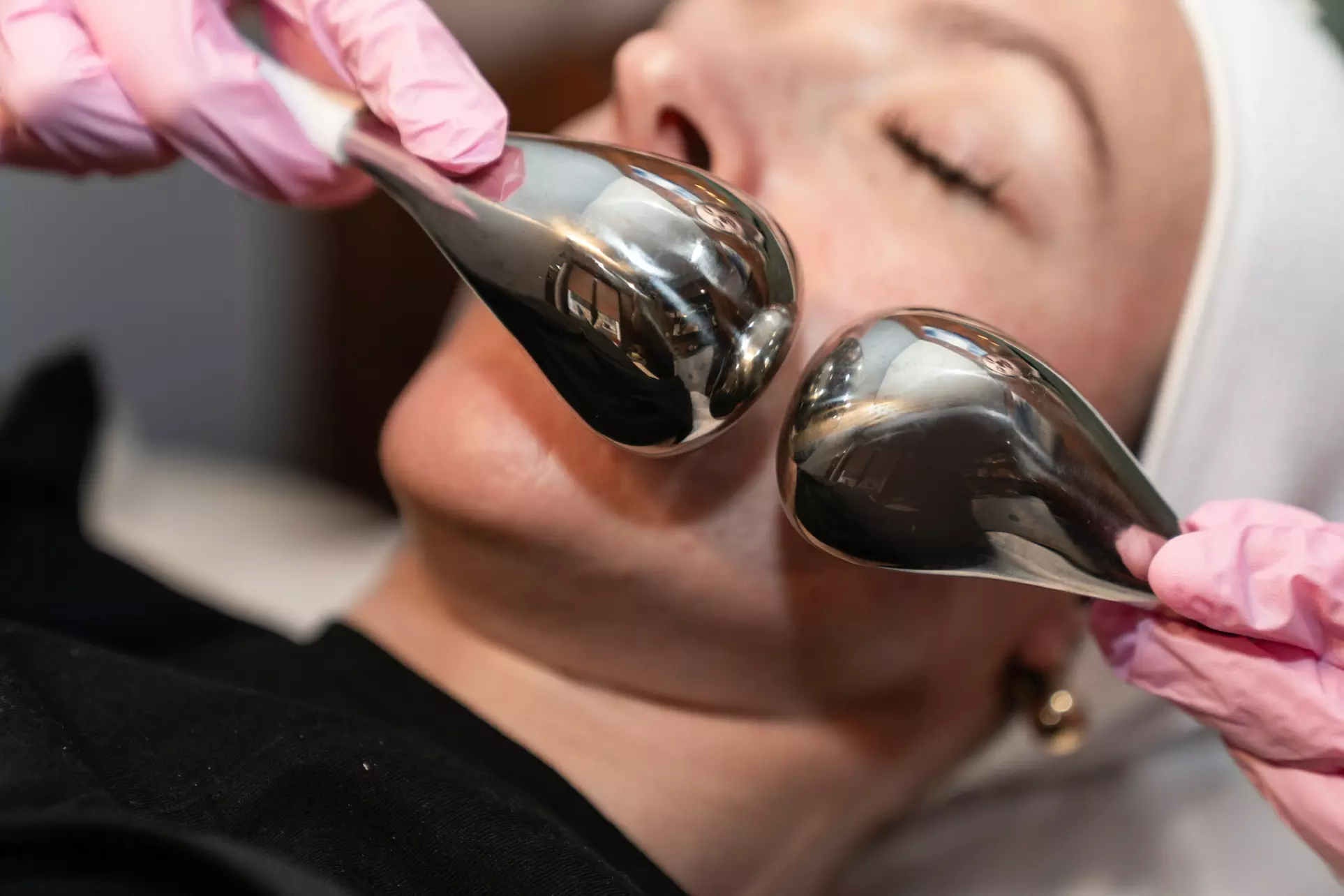 Get a Medical-Grade Chemical Peel at W Laser (Up to 55% Off)