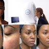 Image 1: LED, peeling, hydratation, anti-âge : soin visage au choix à Bruxelles