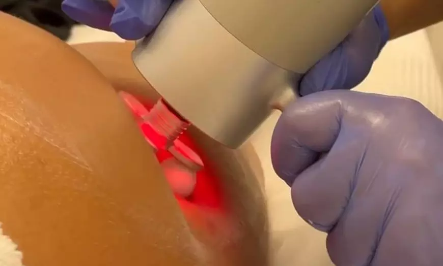Image 2: 3 sesiones de tratamiento reductor BellAction Duo en zona a elegir