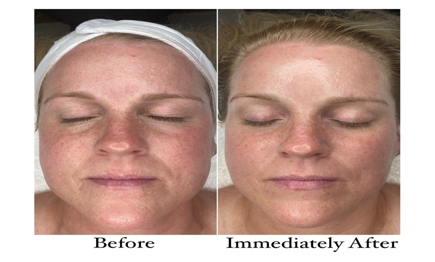 Image 10: Choose Medical Dermalux MD Triwave LED Light Therapy Pak of 10 or 20 