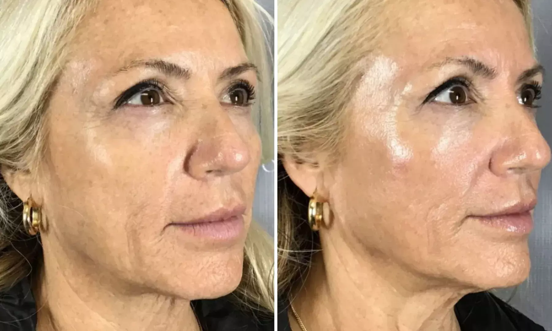 Rejuvenate with Luxurious Facials at River Oaks Galleria Medspa