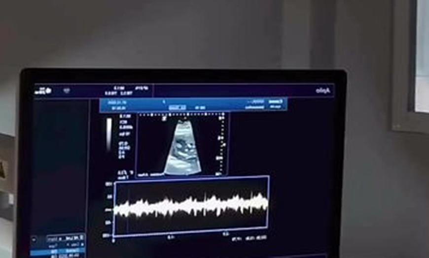 Image 6: Experience a 2D Heartbeat Session with Your Loved Ones