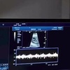 Image 6: Experience a 2D Heartbeat Session with Your Loved Ones