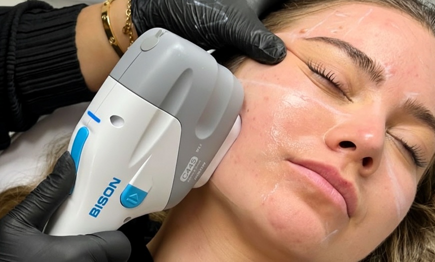 Image 1: Transform Your Appearance with Non-Surgical HIFU Options