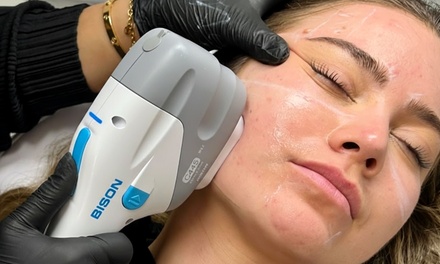 HIFU Chin or Jowls Area - JT Cosmetics