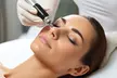 Microderm and Vitamin C Infusion, or Microderm, LED, RF and Vitamin C Infusion at Miami Kiss (Up to 41% Off) - Image 2