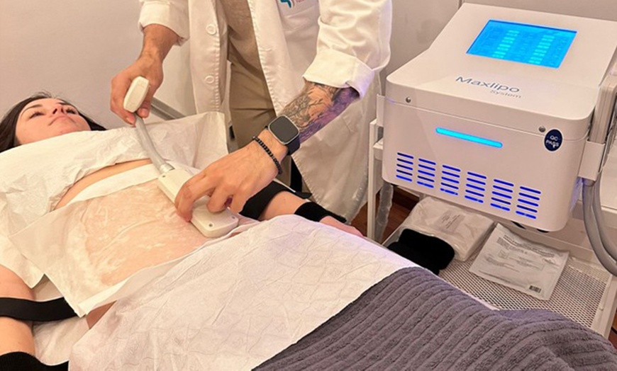 Image 3: Reduce la grasa con hasta 2 sesiones de criolipólisis y EMSculpt