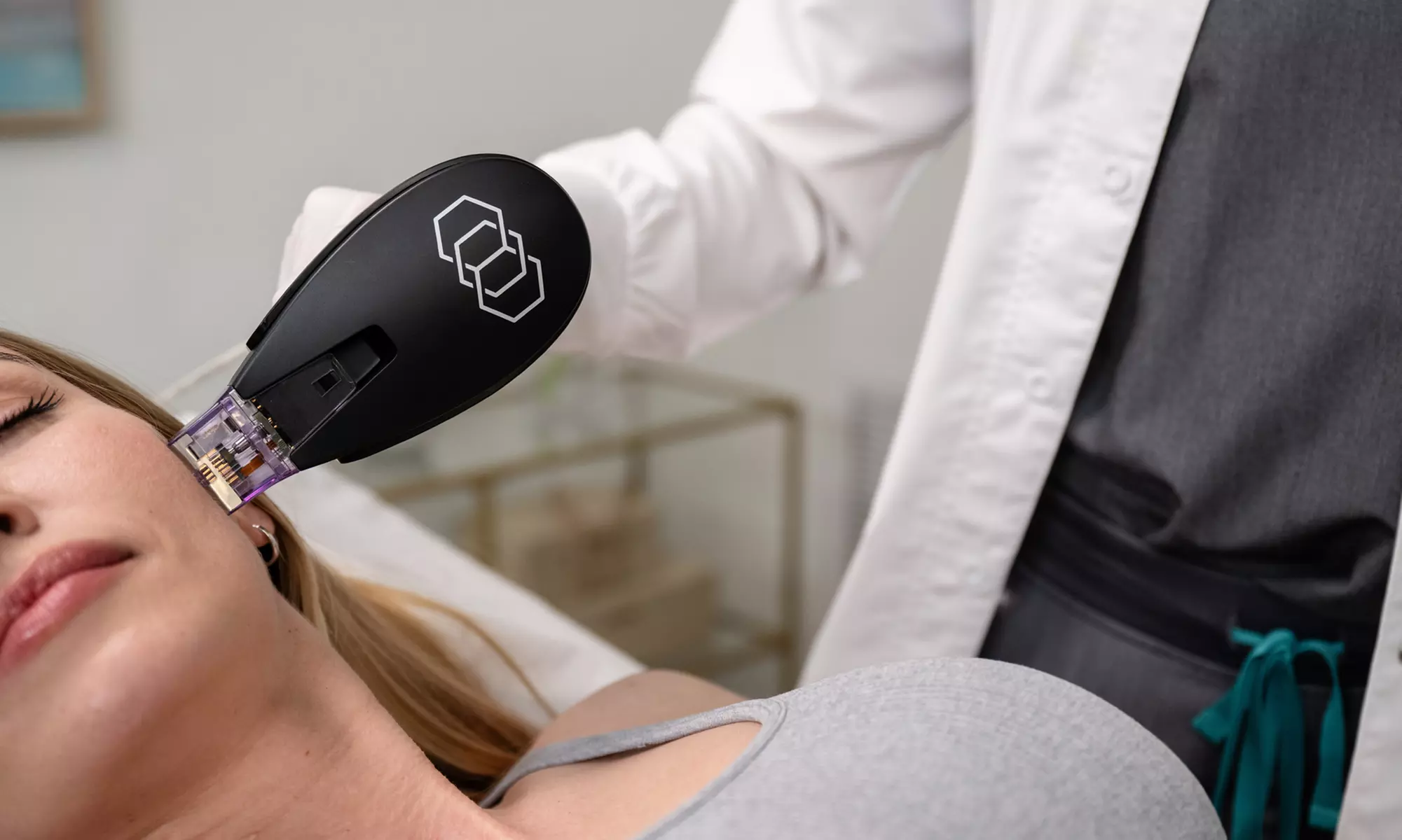 For U Offers Morpheus8 Burst RF Skin Tightening for Full Face with Optional Neck, or Abdomen (Up to 50% Off) - Primary Image