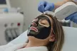 59% Off Carbon Laser Facial for a Radiant, Clear Complexion - Image 2