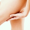 Image 1: Transform Your Thighs with Radio-Frequency Skin Tightening