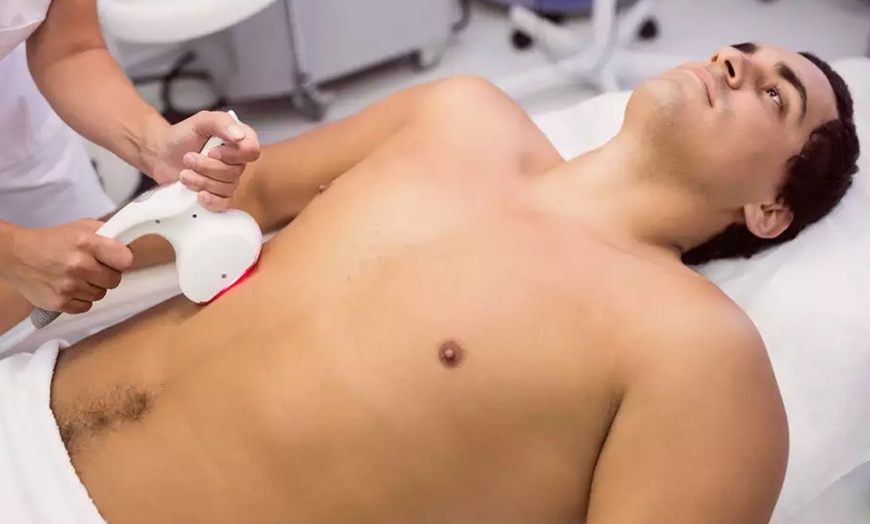 Image 4: Épilation définitive IPL avec Epilation Definitive Depilstime