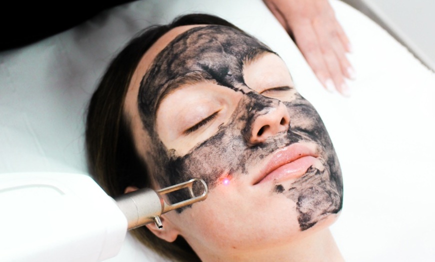 Image 13: Hollywood peeling con mascarilla de carbón activo y láser