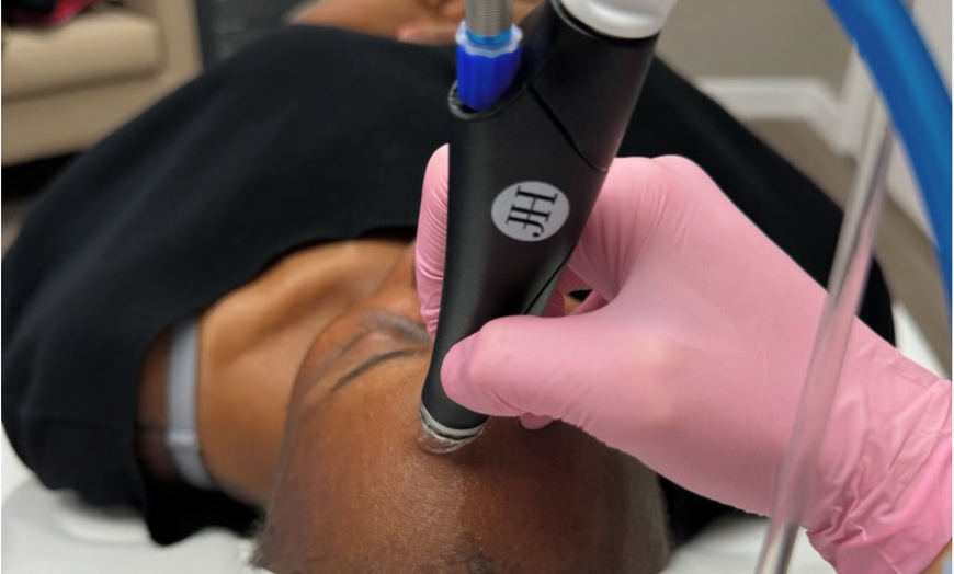 Image 2: Rejuvenate Your Skin with a HydraFacial Treatment