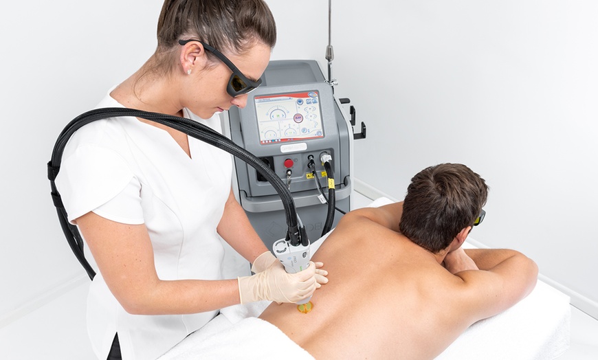 Image 7: Laser Hair Removal