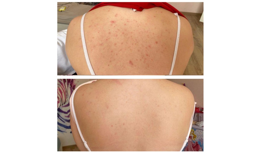 Image 5: Higiene profunda espalda con baño de luna aclaradora 50 minutos