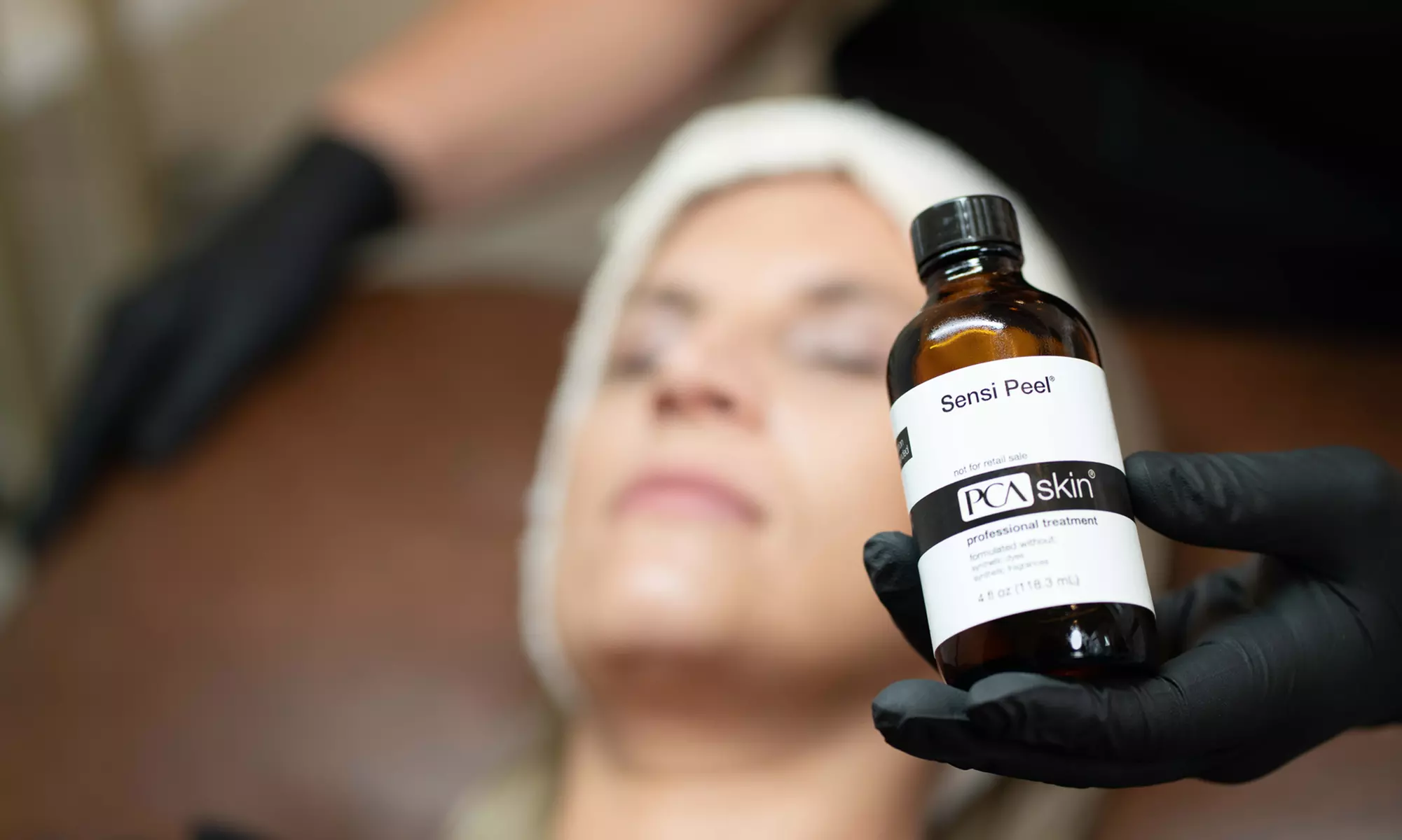 Target Pigmentation with 30 Min PCA Correct Peel, Chemical