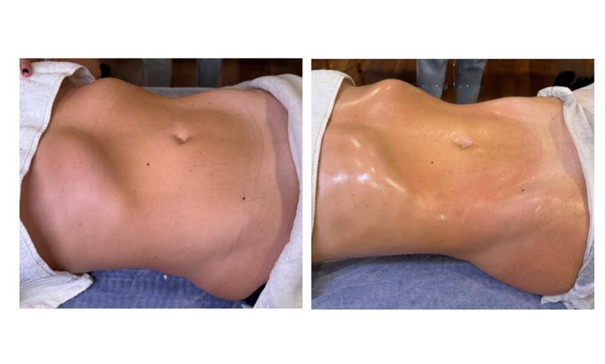 Image 5: 1, 2 o 4 sesiones de drenaje linfático brasileño en una zona a elegir 