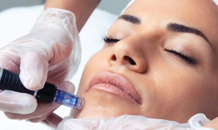 1 Gesichtsbehandlung à 60 Min. mit Microneedling, Vitamin C- und Hyaluron-Serum für 1 Person - DiSi Laser & Beauty