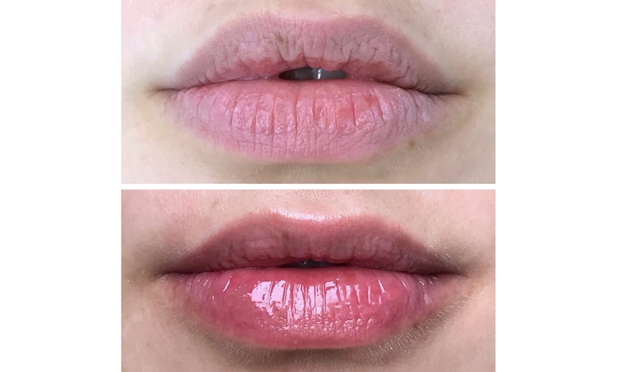 Image 6: Hydrating Lip Drip Treatment with/without Color Boost