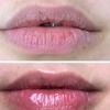 Image 6: Hydrating Lip Drip Treatment with/without Color Boost