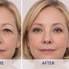Image 5: LASIK Custom Optimized Laser Eye Surgery for One Eye or Both Eyes