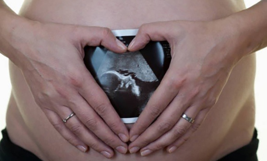 Image 2: Up to 37% Off on Ultrasound - 3D / 4D at Miracle Ultrasound And Spa Llc