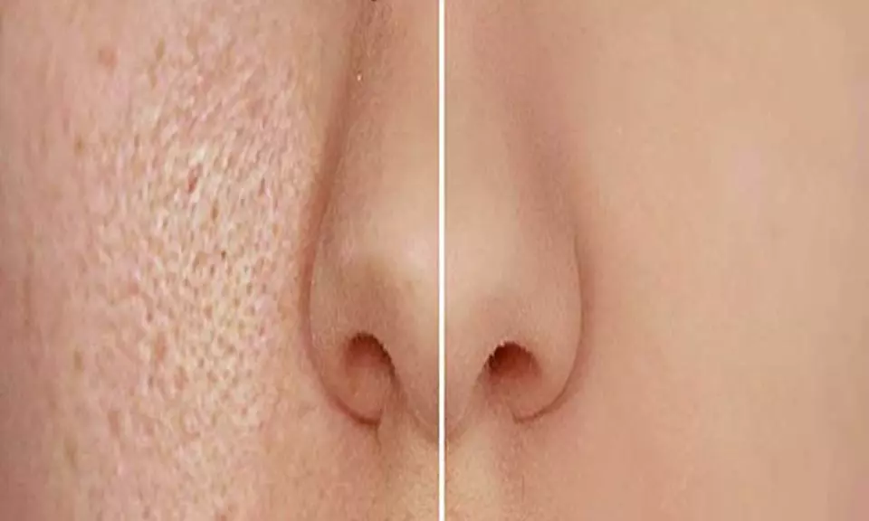 Glow & Sculpt: Body Wrap + Facial with  Optional LED Light Boost