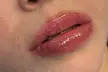 1 o 2 sesiones de rehidratación de labios con dermapen para 1 persona, con hasta un 38% de descuento - Image 2