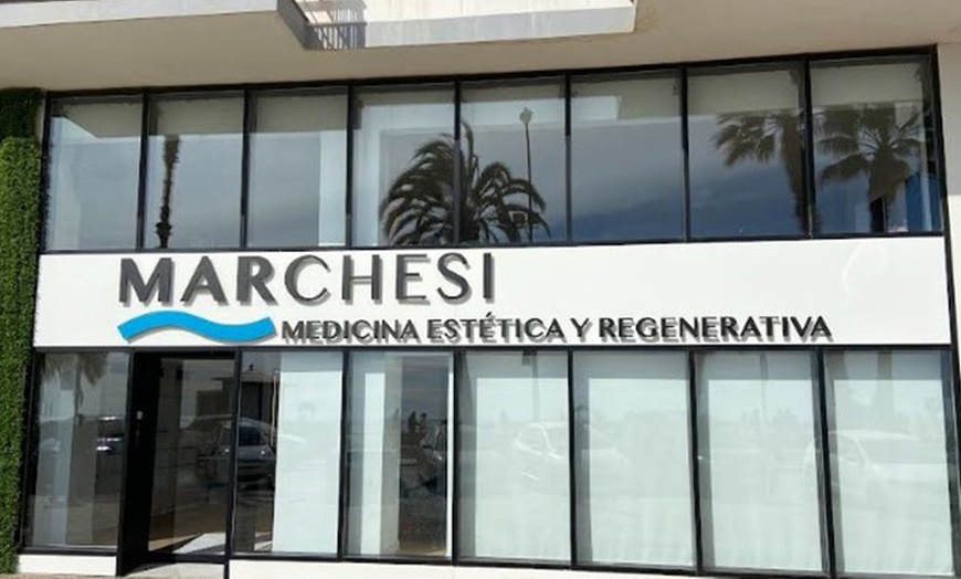 Image 3: Tratamiento reafirmante inyectado con opción a mesoterapia y/o retoque