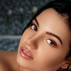 Image 1: RHA dermal fillers for natural facial volume & expression enhancement